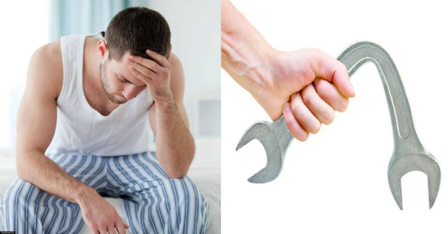 Příznaky prostatitidy